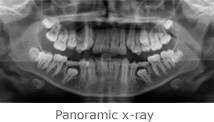 pano x ray